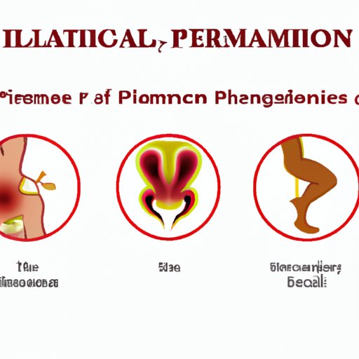 III. Common Causes of Pelvic Inflammatory Disease